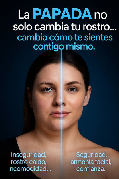 VFACE Reductor de Papada Importado®